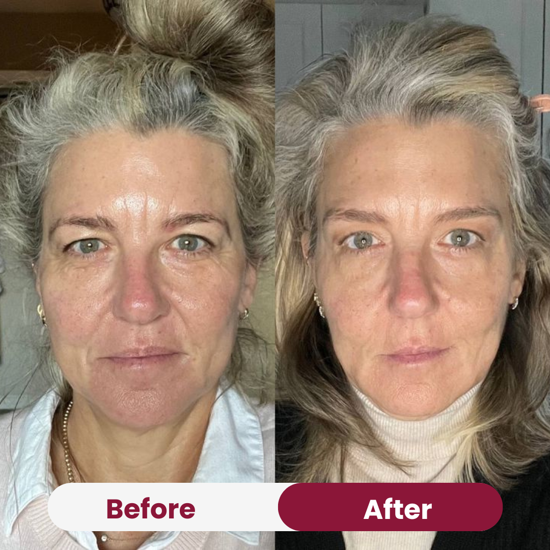 Anti-Wrinkle Collagen Mask 31 105